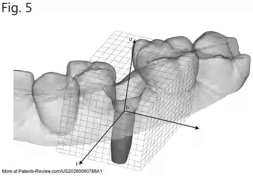 PatentPulse's tweet image. Discover the future of #DentalTech with patent application #US20260060788A1 by #DentsplySirona. This innovation uses #MachineLearning for real-time, customized dental designs, including crowns &amp;amp; abutments. It ensures immediate validation of patient-specific treatment plans.