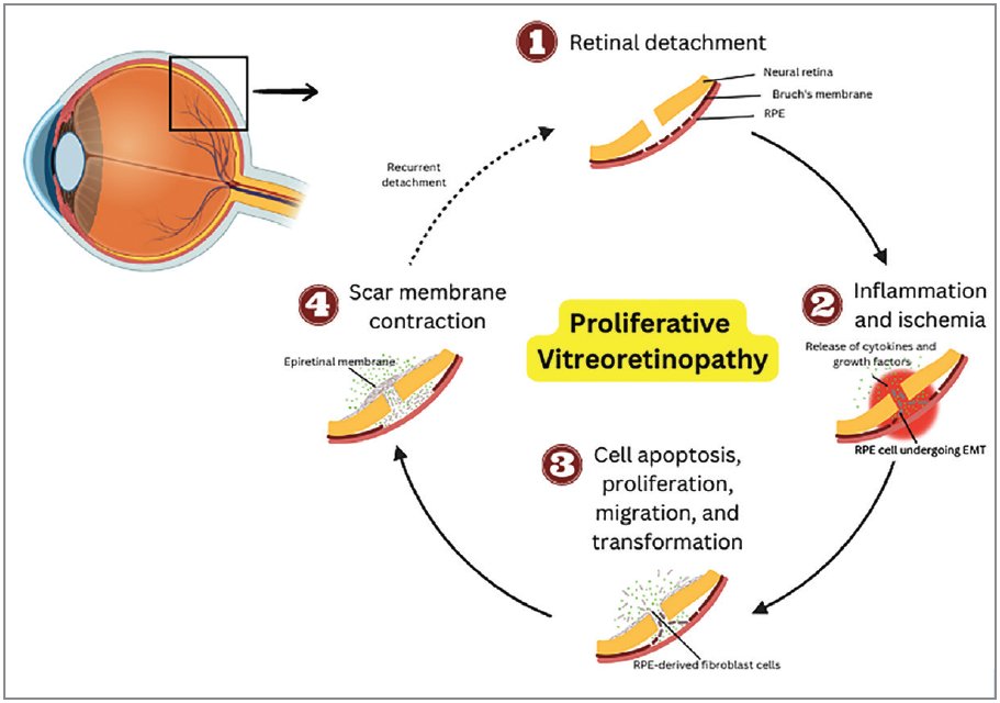 Retina Specialist tweet media