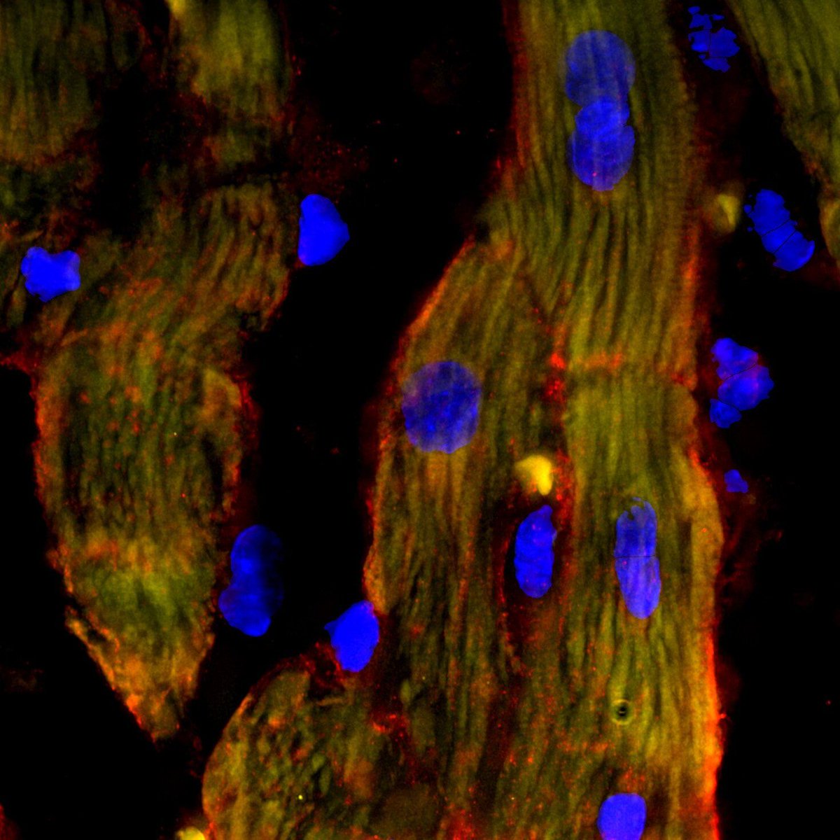 ahier's tweet image. #CRISPR-based technique unlocks healing power of mitochondria for heart failure therapy    

phys.org/news/2026-03-c…