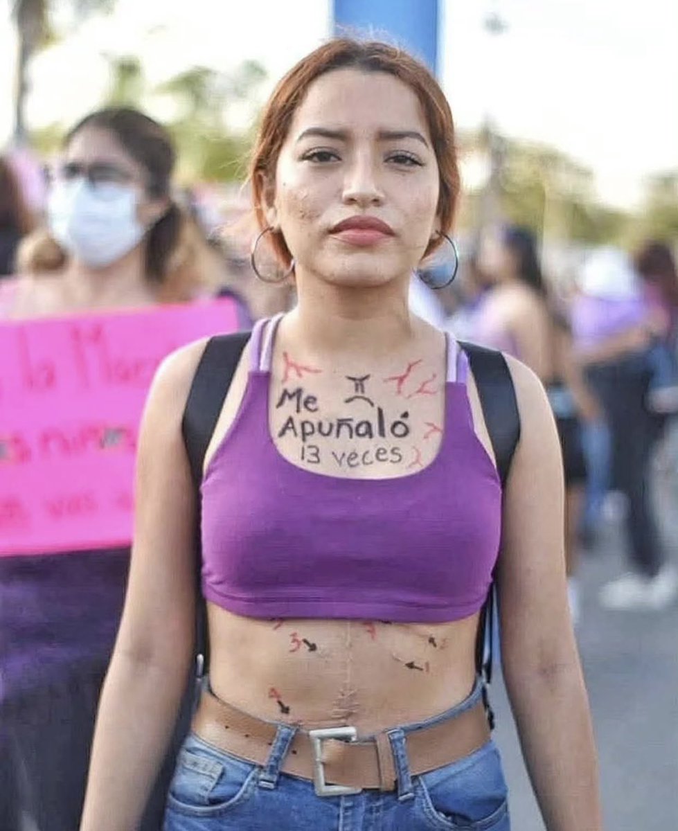 ⚠️🟣 IMPRESIONANTE | Ella es Michelle, una joven que sobrevivió a las 13 puñaladas de su pareja ⚠️🟣

Michelle, salió a marchar exhibiendo las cicatrices en su cuerpo, hechas por su agresor, ella luchó contra la muerte y ganó la batalla.