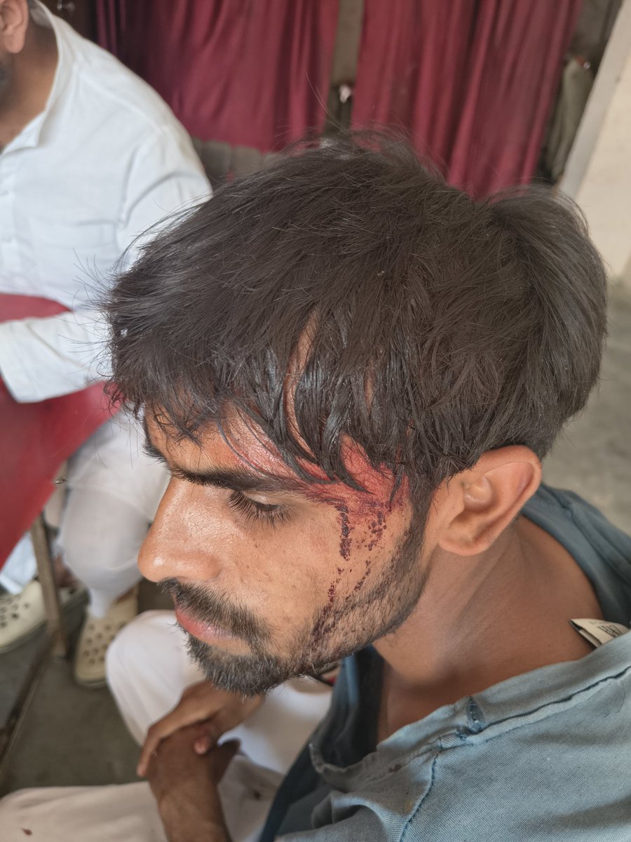 R7NewsLive's tweet photo. मेरठ मुंडाली थाना क्षेत्र के गांव लौटी मे रास्ते के मामूली विवाद ने हिंसक रूप ले लिया। दबंगों ने लाठी डंडो और लोहे की रॉड से हमला कर शहबाज को गंभीर रूप से घायल कर दिया।बीच बचाव करने पहुंचे वर्तमान प्रधान को भी गालियां देकर जान से मारने की धमकी दी गई।
@meerutpolice कार्रवाई करेगी? https://t.co/hr01q4JTkQ