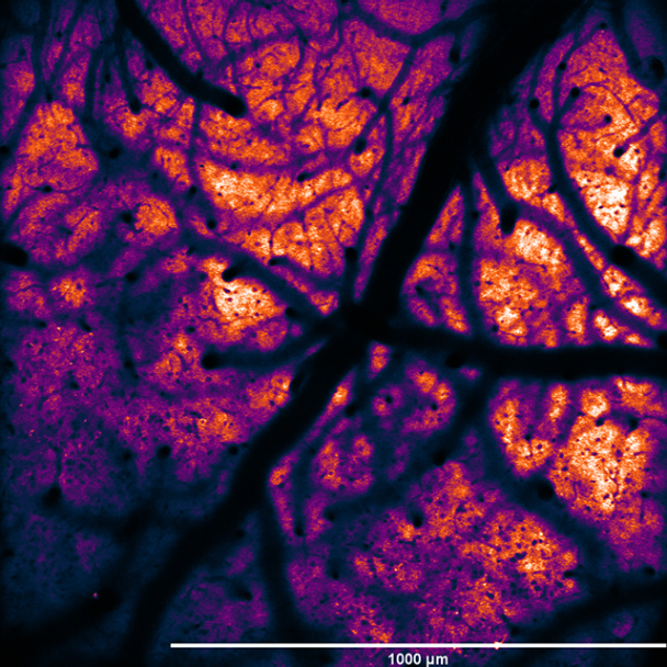 Bruker Fluorescence Microscopy tweet media