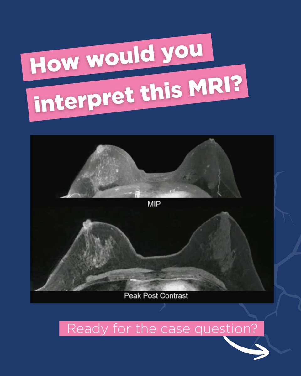 Society of Breast Imaging tweet media