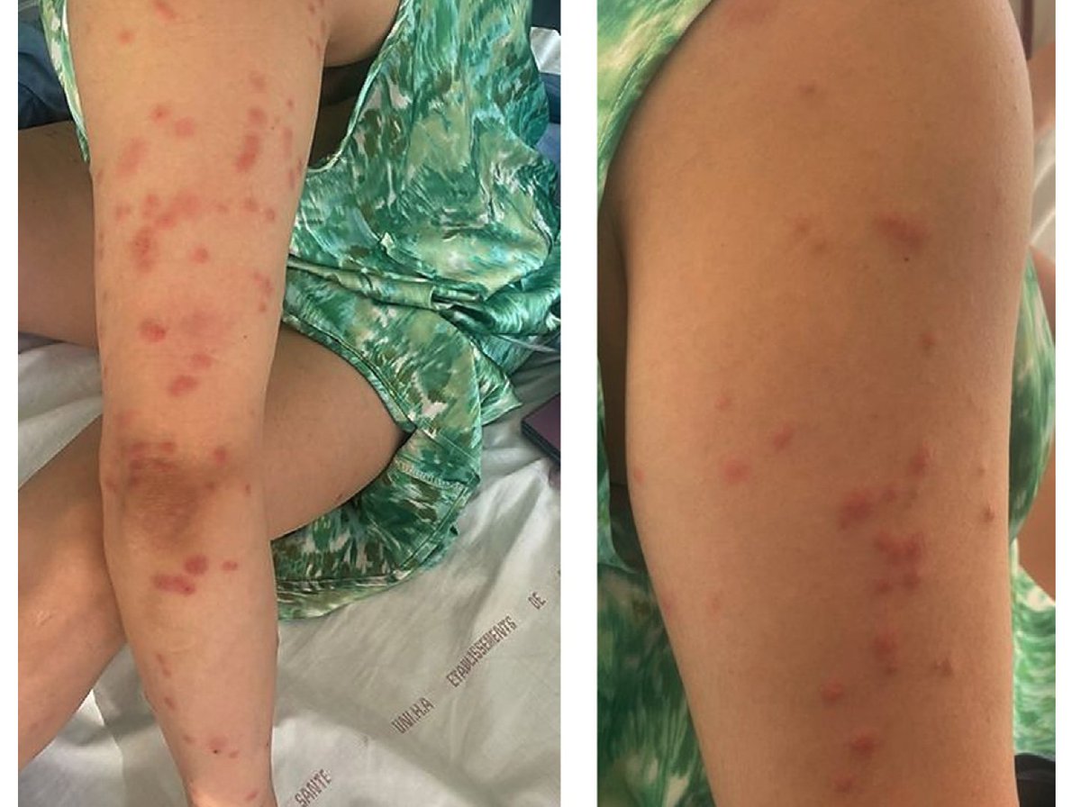 La Revue de Médecine Interne tweet media