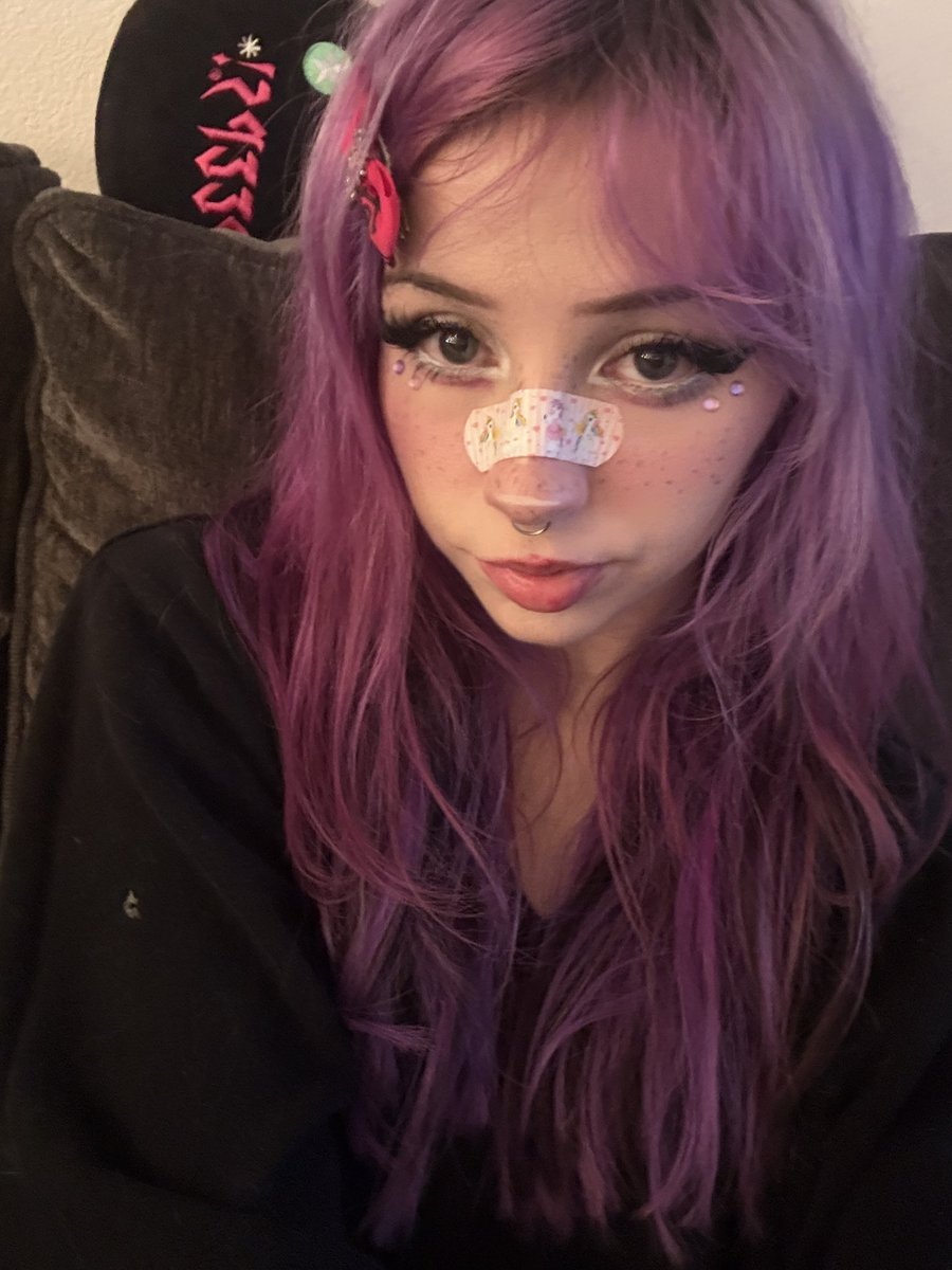 Skye binxy tweet media