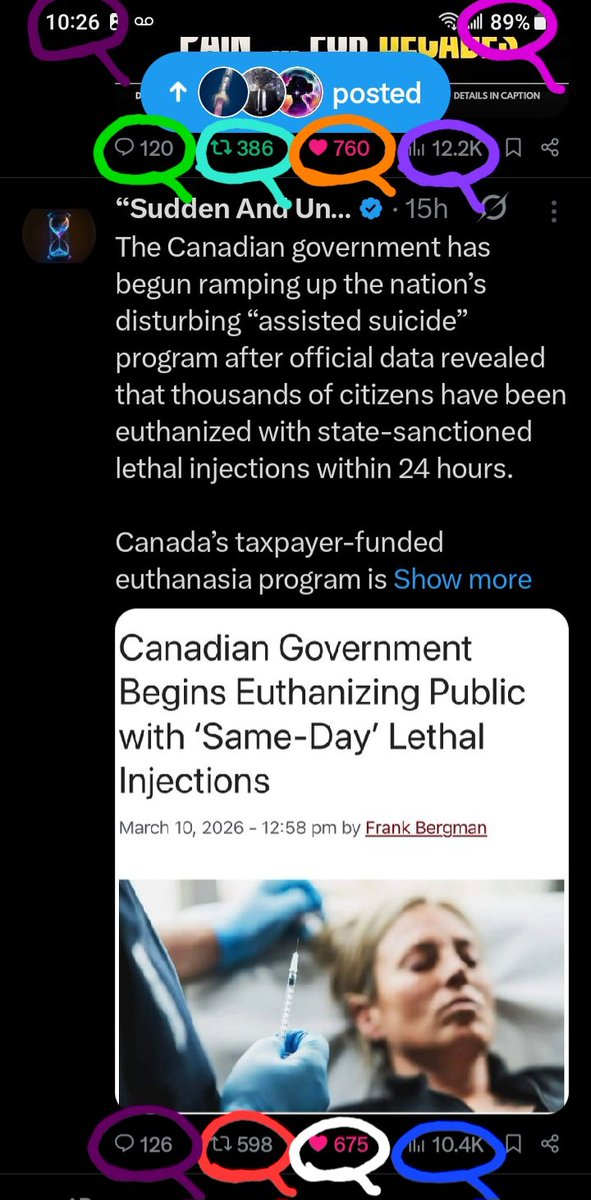 DeanDavis33's tweet image. 1️⃣0️⃣4️⃣ #TenFour 🐇
😎8️⃣9️⃣ #EightyNine 
1️⃣2️⃣6️⃣ #OneTwoSix 🪞
1️⃣2️⃣2️⃣ #OneTwoTwo 
1️⃣2️⃣0️⃣ #OneTwoZero 
😏 #WhatAreTheOdds 🤣
6️⃣7️⃣5️⃣ #SixSevenFive 
5️⃣9️⃣8️⃣ #FiveNineEight 
7️⃣6️⃣0️⃣ #SevenSixZero 
3️⃣8️⃣6️⃣ #ThreeEightSix 🐸