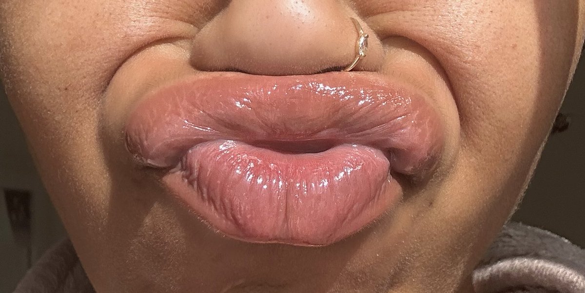 juicylipaura's tweet photo. natural or glossy? 👄 #lipfetish #DSL #liplovers #upperlip #upperlipsmell #upperlipsmelling #biglips #juicy #kissable https://t.co/N16KPqx7kX
