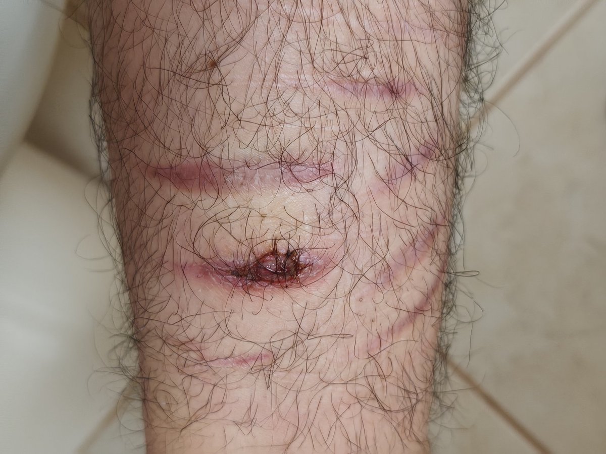 yoshiki of shedtwt tweet media