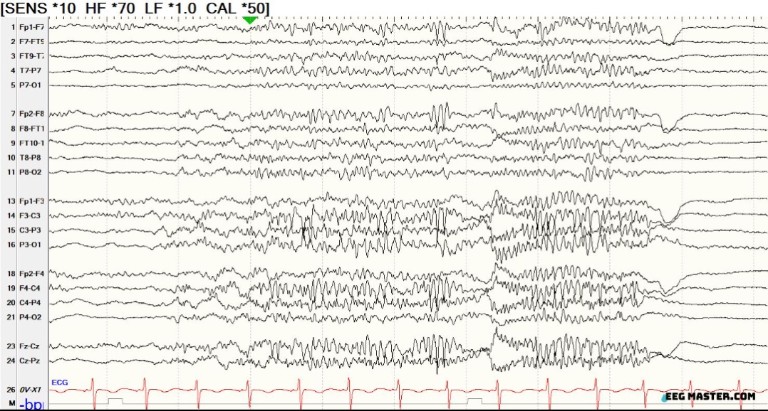EEG Master tweet media