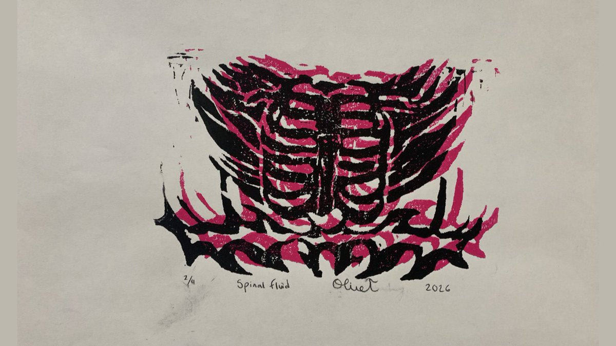 MidtownHighArt's tweet photo. "Spinal Fluid" linocut print
@APSMidtown @insideAPSarts #insideapsarts #art #artclass #highschoolart #arteducation #spinalfluid #spine #spinal #skeleton #bones #linocut #printmaking https://t.co/hRctBzX4Yv