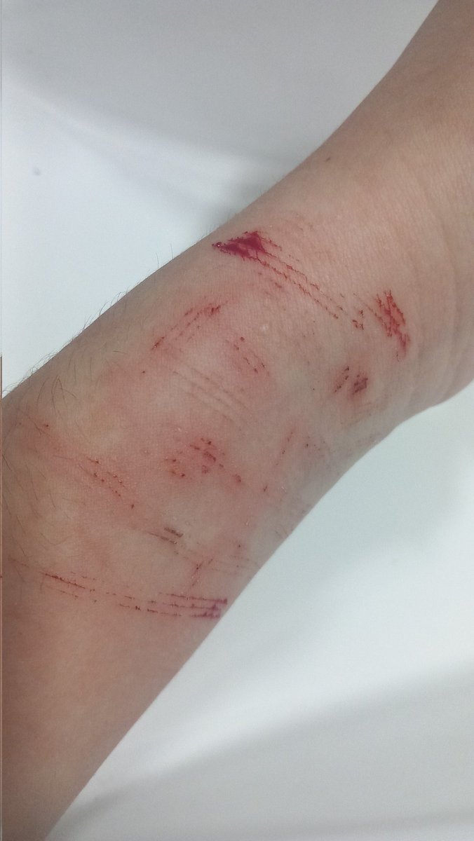 _ddevotion's tweet photo. I'm trynna cut deeper cuz what are these cat scratches 😭😭🙏🙏 #shwtwt https://t.co/B06L1QFI8l