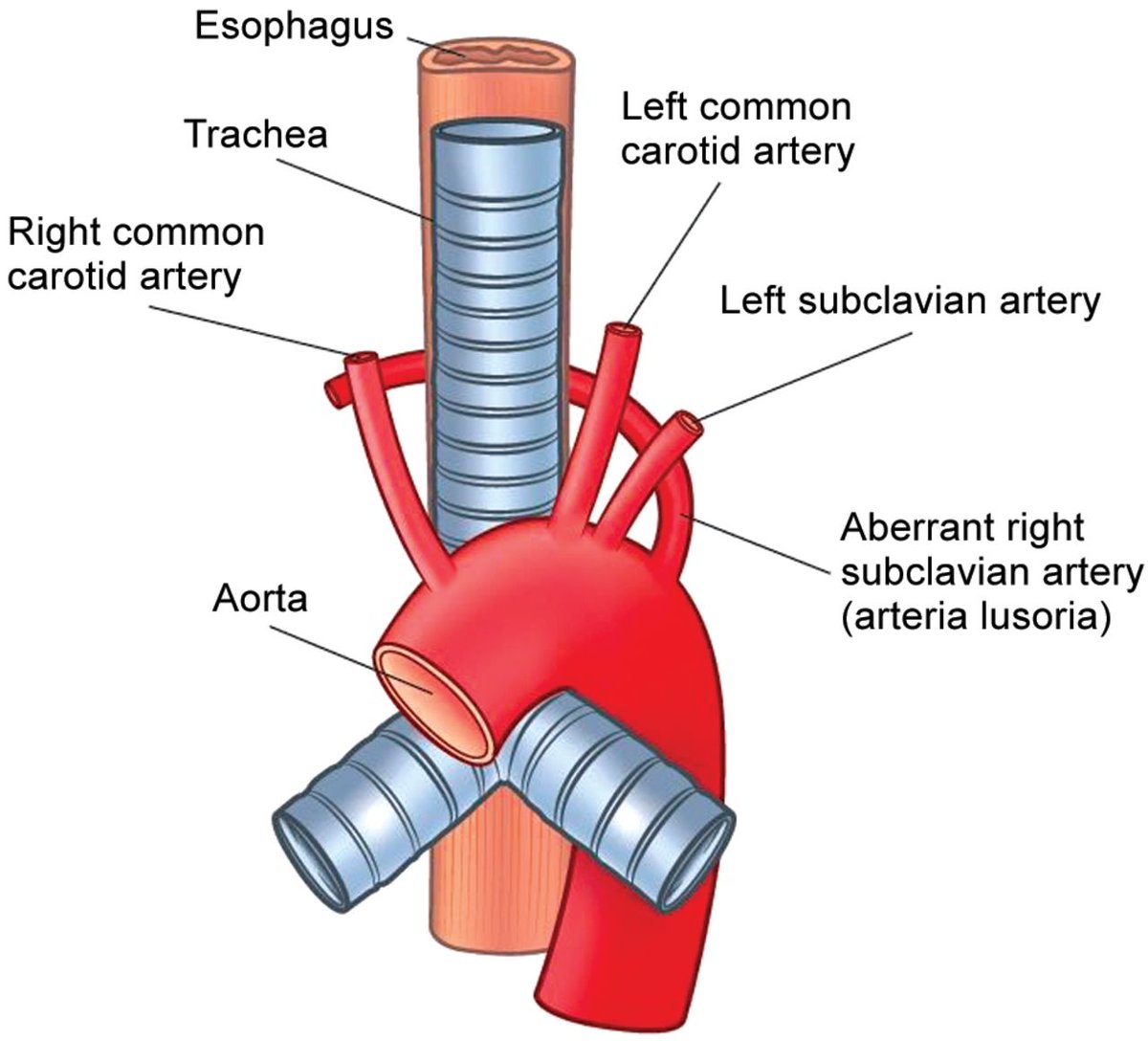 DrDimleek's tweet photo. Lusoria Artery! https://t.co/nC1ii0Qgzp