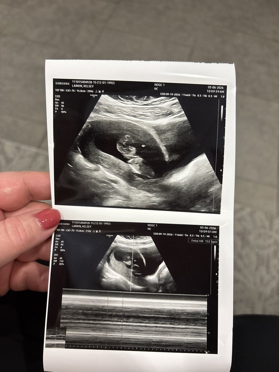 Jesse Larkin tweet media