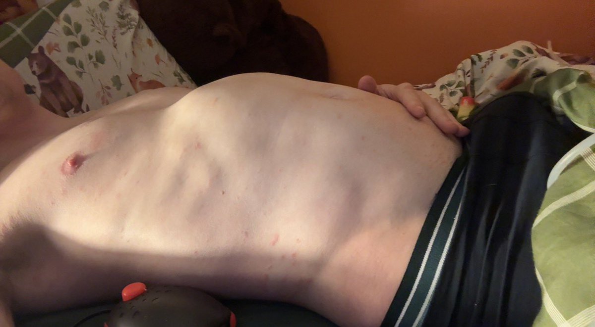 🎈 moose | NSFW tweet media