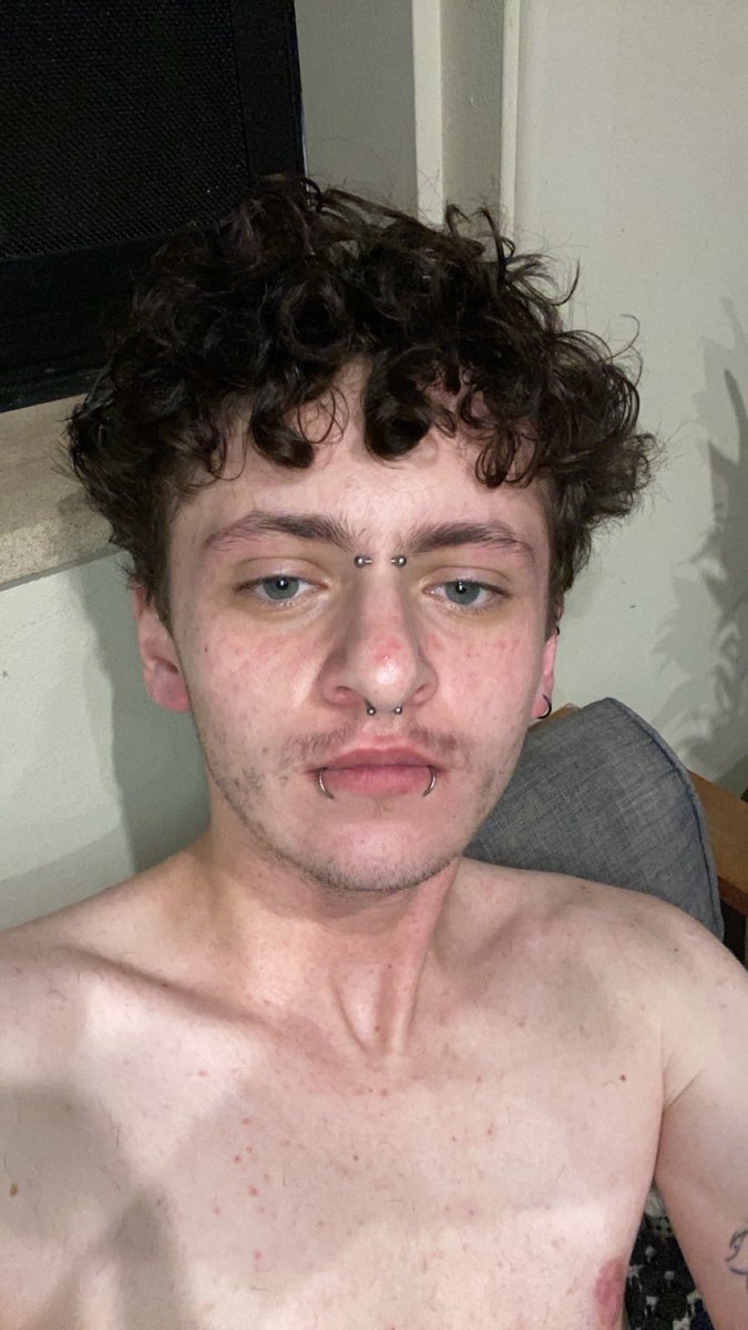 in0suki's tweet photo. wow throwback to exactly one year ago, FUCK lamotrigine. i ended up in hospital for 3 days :’) https://t.co/fetvVsgBW3