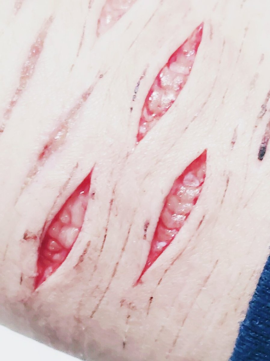 himariaawho's tweet photo. january 💗 i've only been doing thighs and upper arm in feb due to getting caught :(
end of 🧵 https://t.co/6fwR6glF8c