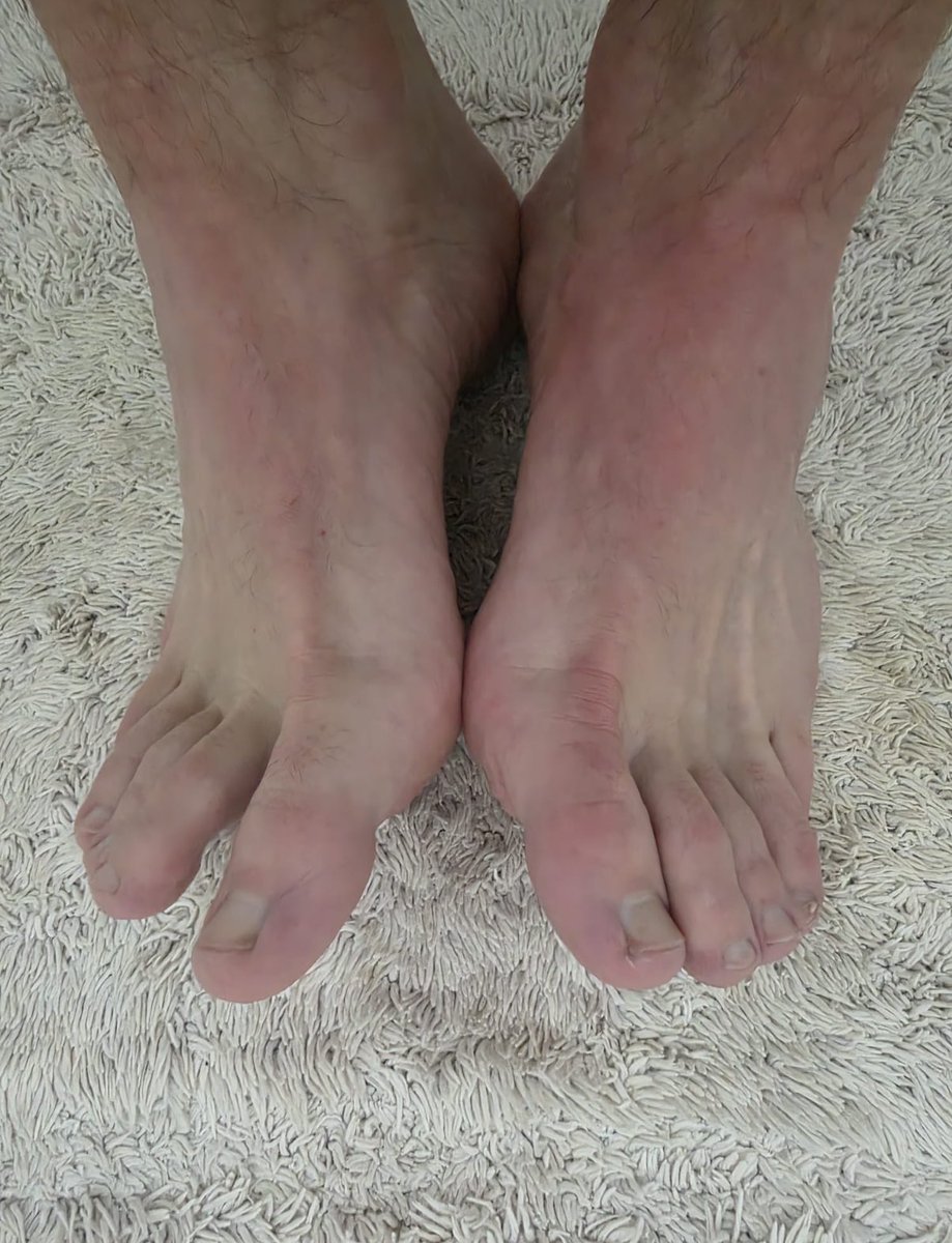 BootneckB57331's tweet photo. Fresh out of the shower.
#exmilitary #bootneck #feetfetısh https://t.co/1UsIag12dL