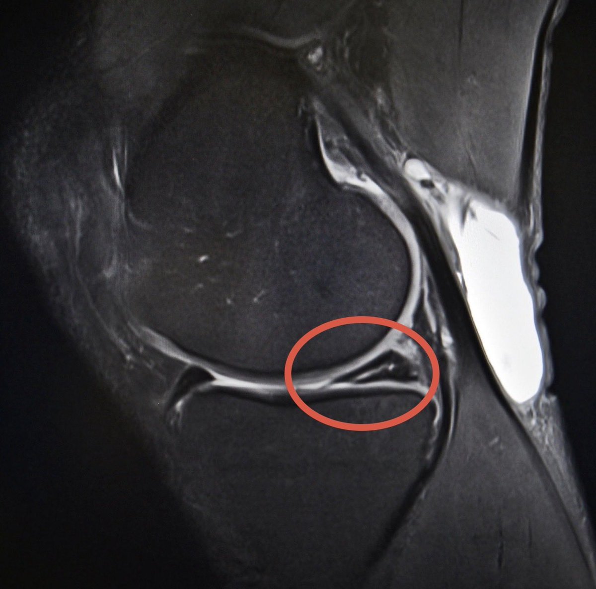 Jesse Morse, M.D. tweet media