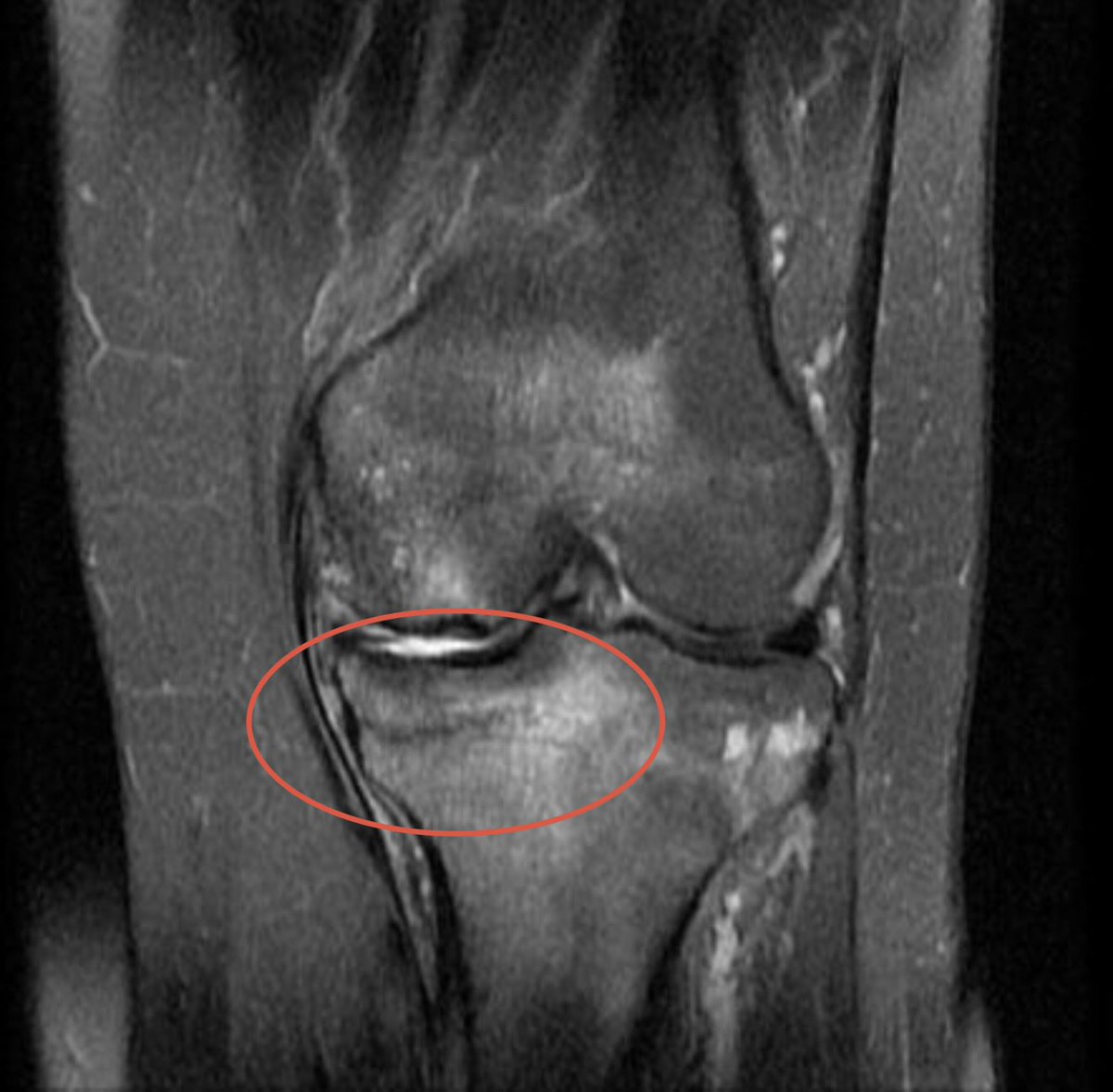 Jesse Morse, M.D. tweet media