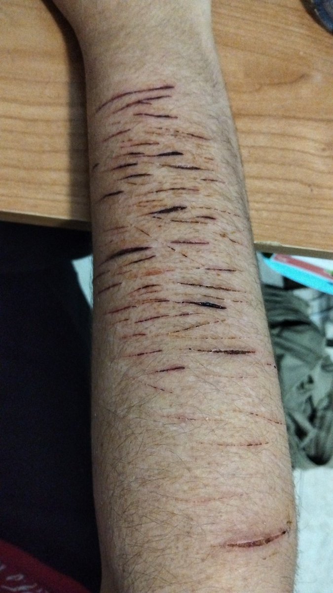 𝒢℘ JX1 of ꜱʜᴇᴅᴛᴡᴛ ♱ 🪶 tweet media