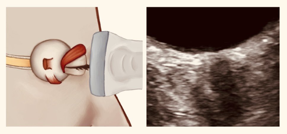 aaron tito santiago tweet media