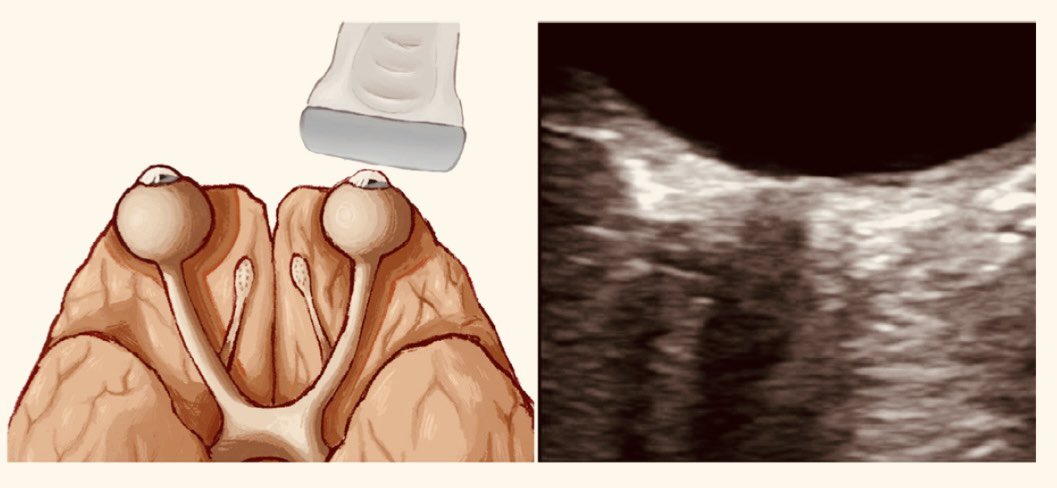 aaron tito santiago tweet media