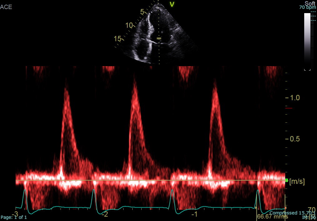 Priscilla Wessly tweet media