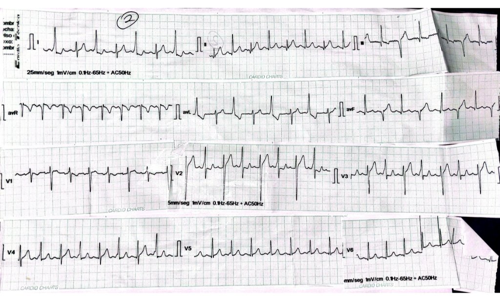 Nelson Polo Taborda tweet media