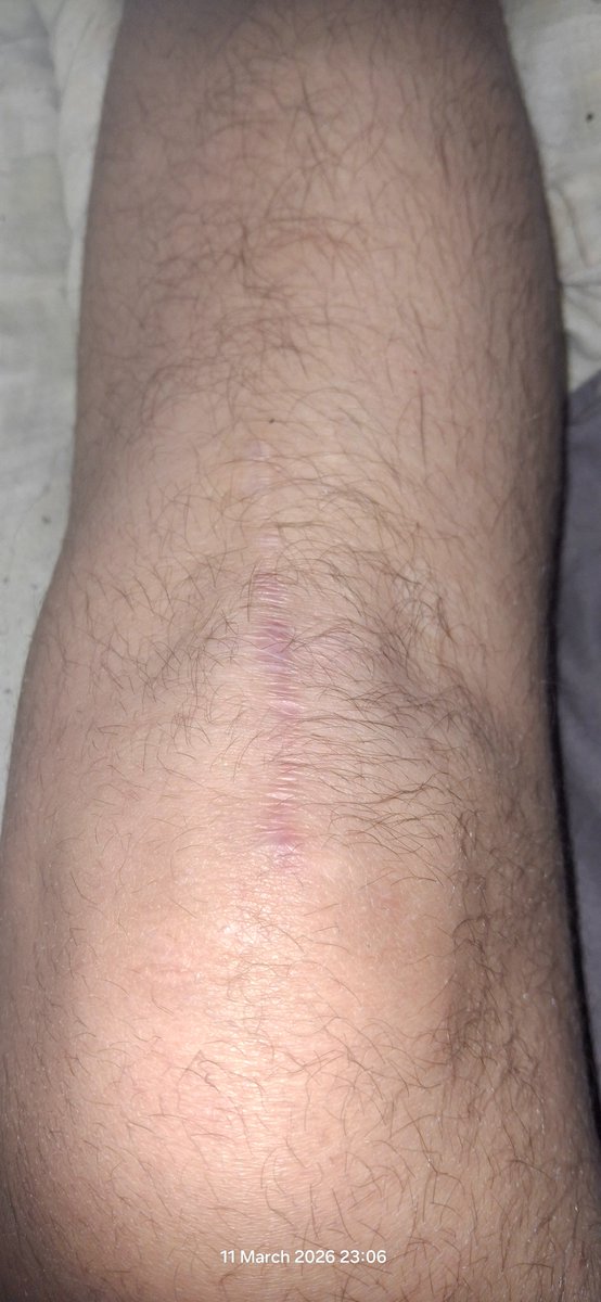 Thomas Berman tweet media