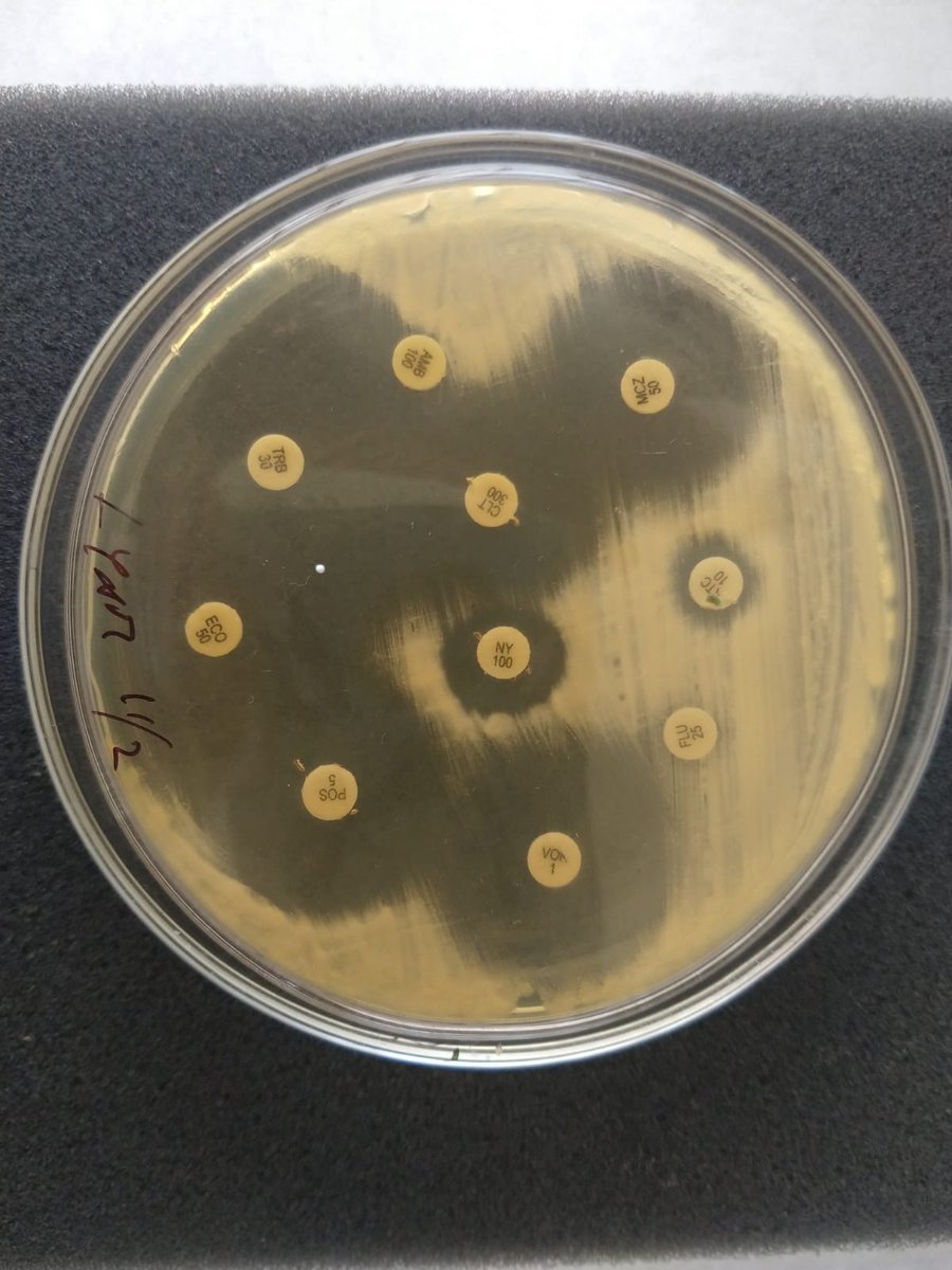 kmlaboratorio's tweet photo. #KMLaboratorio_PatologiaClinica
🧫 Antimicograma: Test de laboratorio que determina a qué antifúngicos es sensible o resistente un hongo, ayudando a elegir el tratamiento más eficaz. #Microbiología #LaboratorioClínico https://t.co/hJN8akXFCm