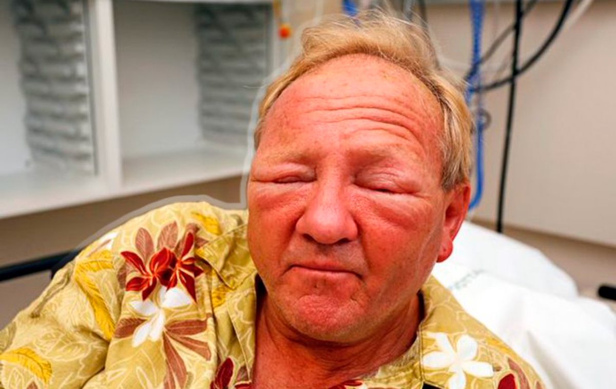 Gunnar Már tweet media