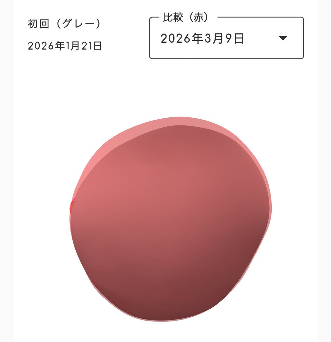 achako_ch's tweet photo. 治療開始後1ヶ月⛑️
✔️1/21に最初の頭部スキャン
✔️2/9に治療開始、3/9に2回目の頭部スキャン
右後頭部が明らかに膨らんできた!!
数値的な指標としても、斜頭度と短頭度がいずれも改善✨
お金かかったけど、確実にやってよかったわ😭🙏
#ヘルメット治療
#babyband https://t.co/NgjM9Daugy
