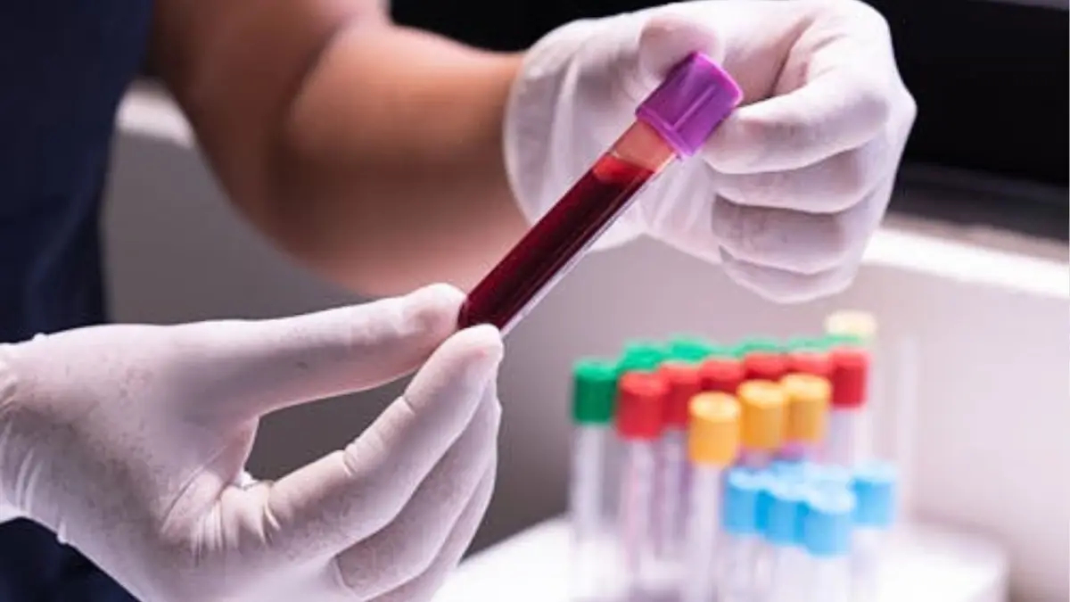 Canal Capital tweet media