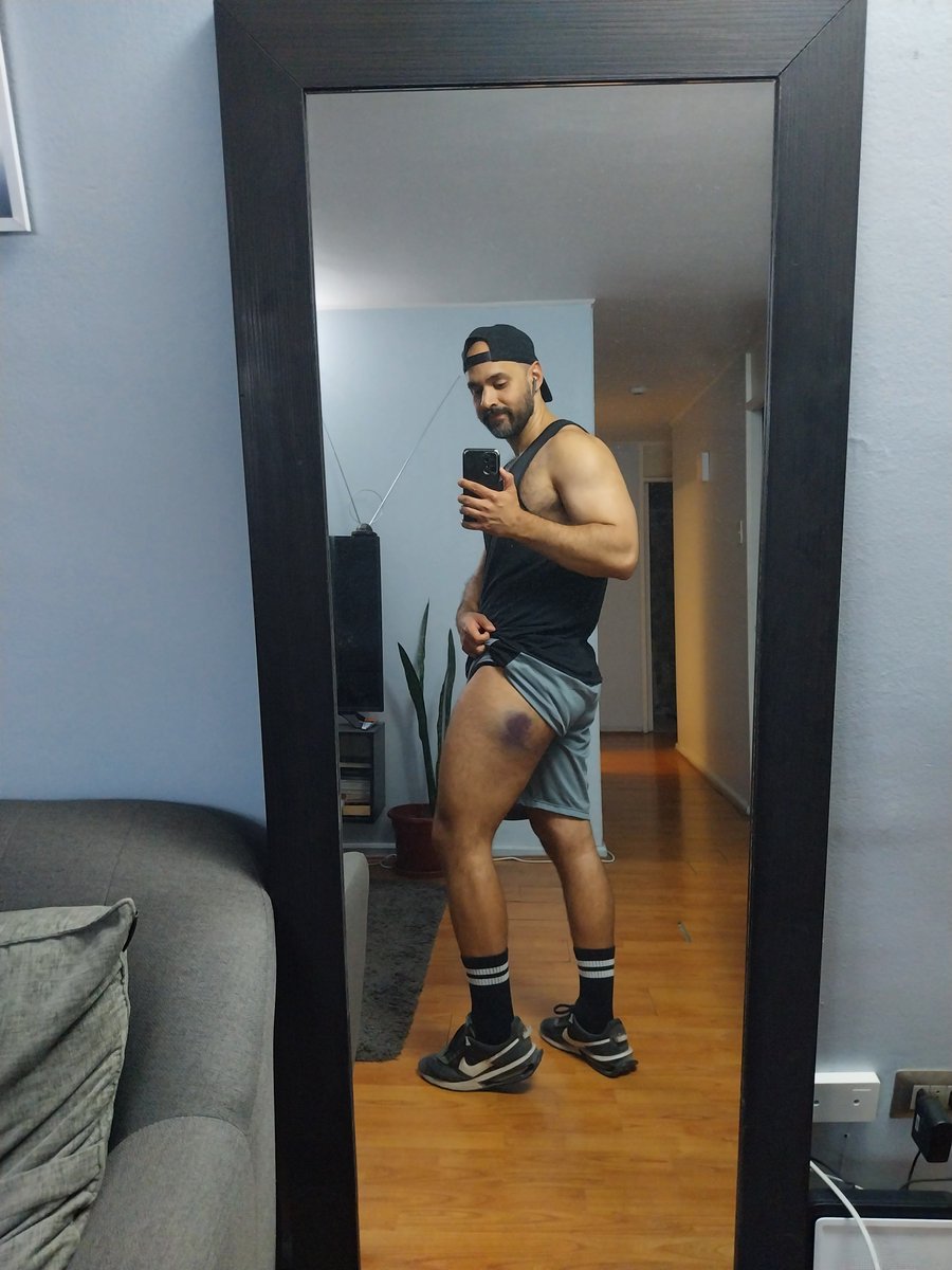 Boyfriendxpr's tweet photo. 🤕 https://t.co/fzc2roooVb