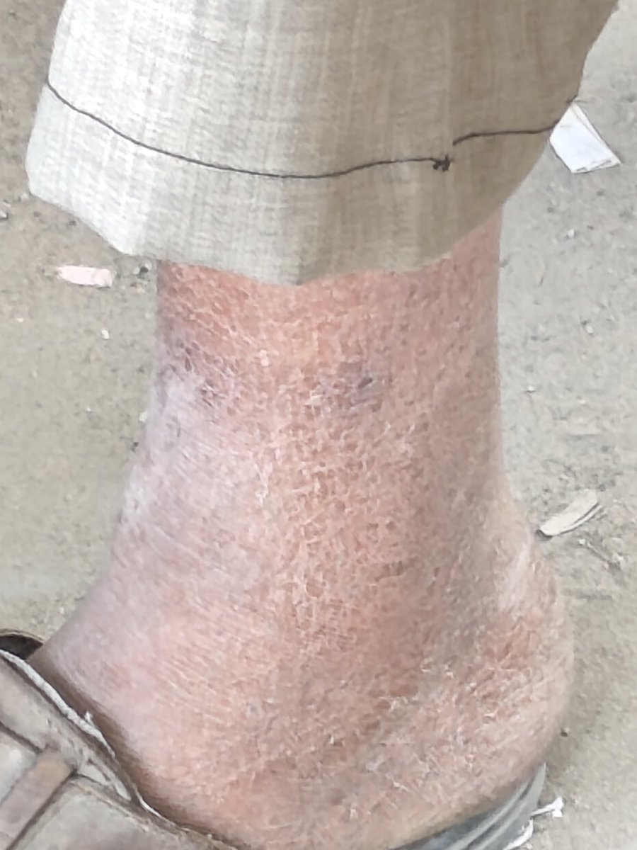 It’s my birthday.

Gifts are accepted.Even if it's $10 
chuffed.org/project/173166…