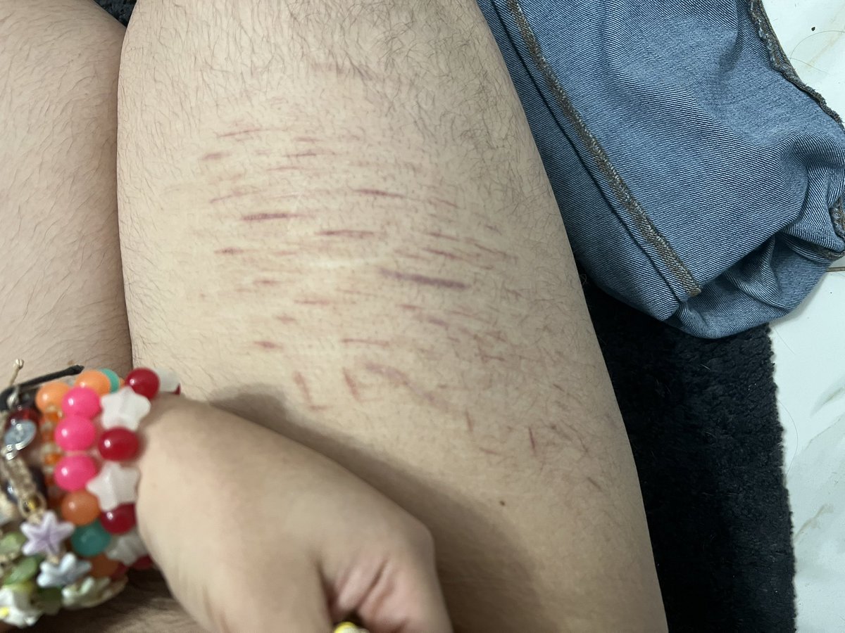 ♱ 𝑩𝑰𝑳𝑳 𝑪𝑰𝑷𝑯𝑬𝑹 𝑶𝑭 𝑺𝑯𝑬𝑫𝑻𝑾𝑻 ♱ tweet media