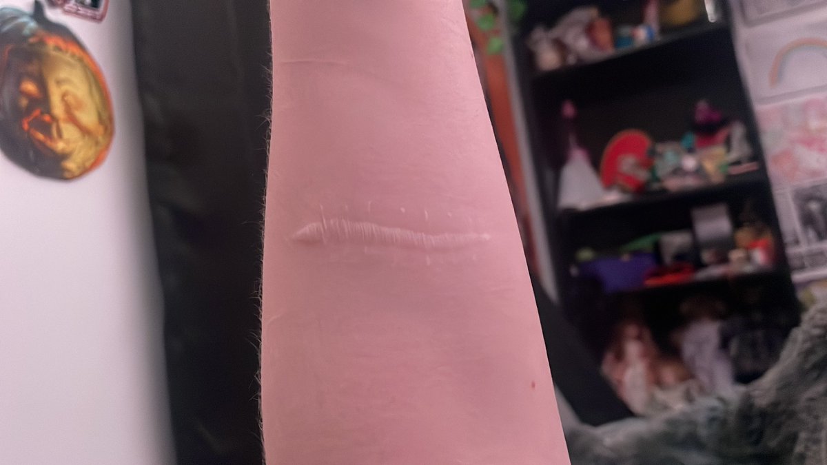 cal0riekitty's tweet photo. @eliasaudience yes. this is the aftermath of me finding out abt these. 4 years later. be CAREFUL https://t.co/WmzYs58Vdp