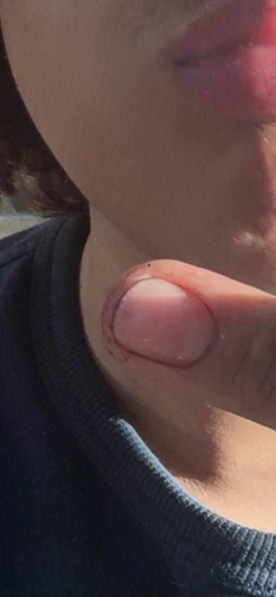 benjskayy's tweet photo. @CardianoB @HdysJdjsjs28899 IJBOL.

No you did not respond to me with those dirty ass fingernailsSSSSS

OMGG https://t.co/KQx1TPZXHh