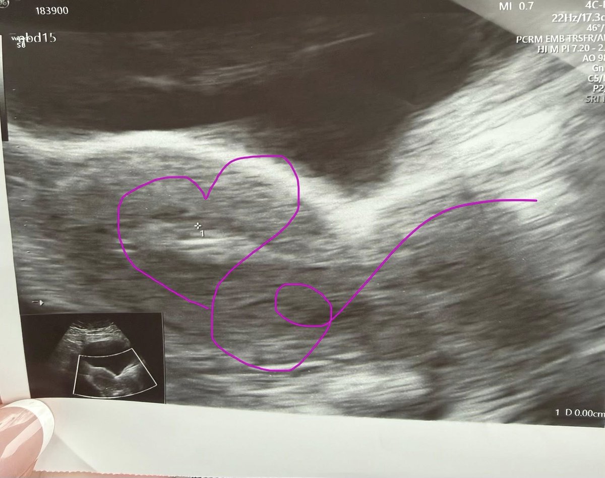 Surrogacy in Canada Online tweet media