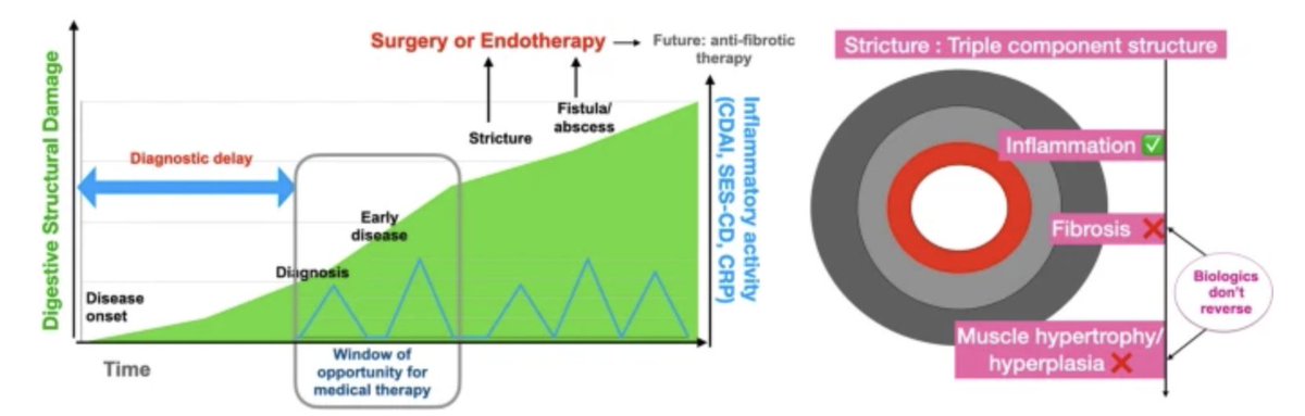 Indian Journal of Gastroenterology tweet media