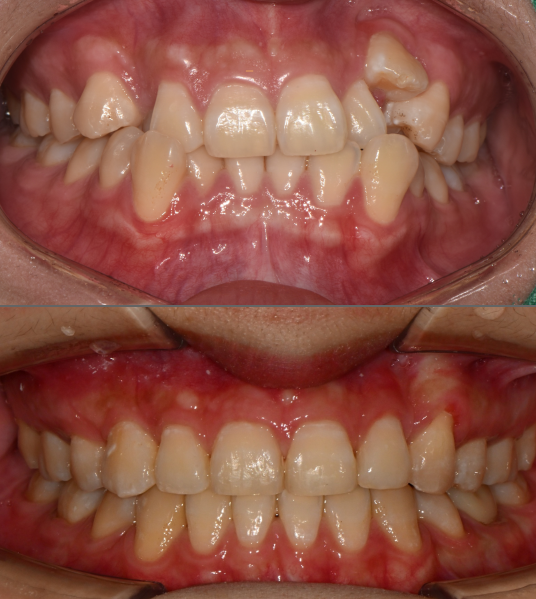 【公式】ル歯科 カンナム歯医者(le:dental clinic) tweet media