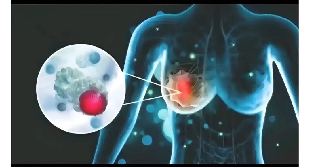 Whiplash347 tweet media