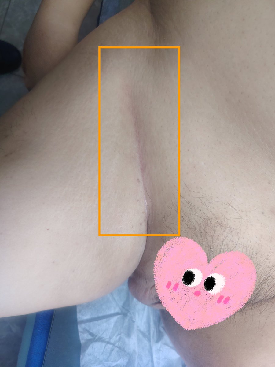 泓悅。保健養生 tweet media