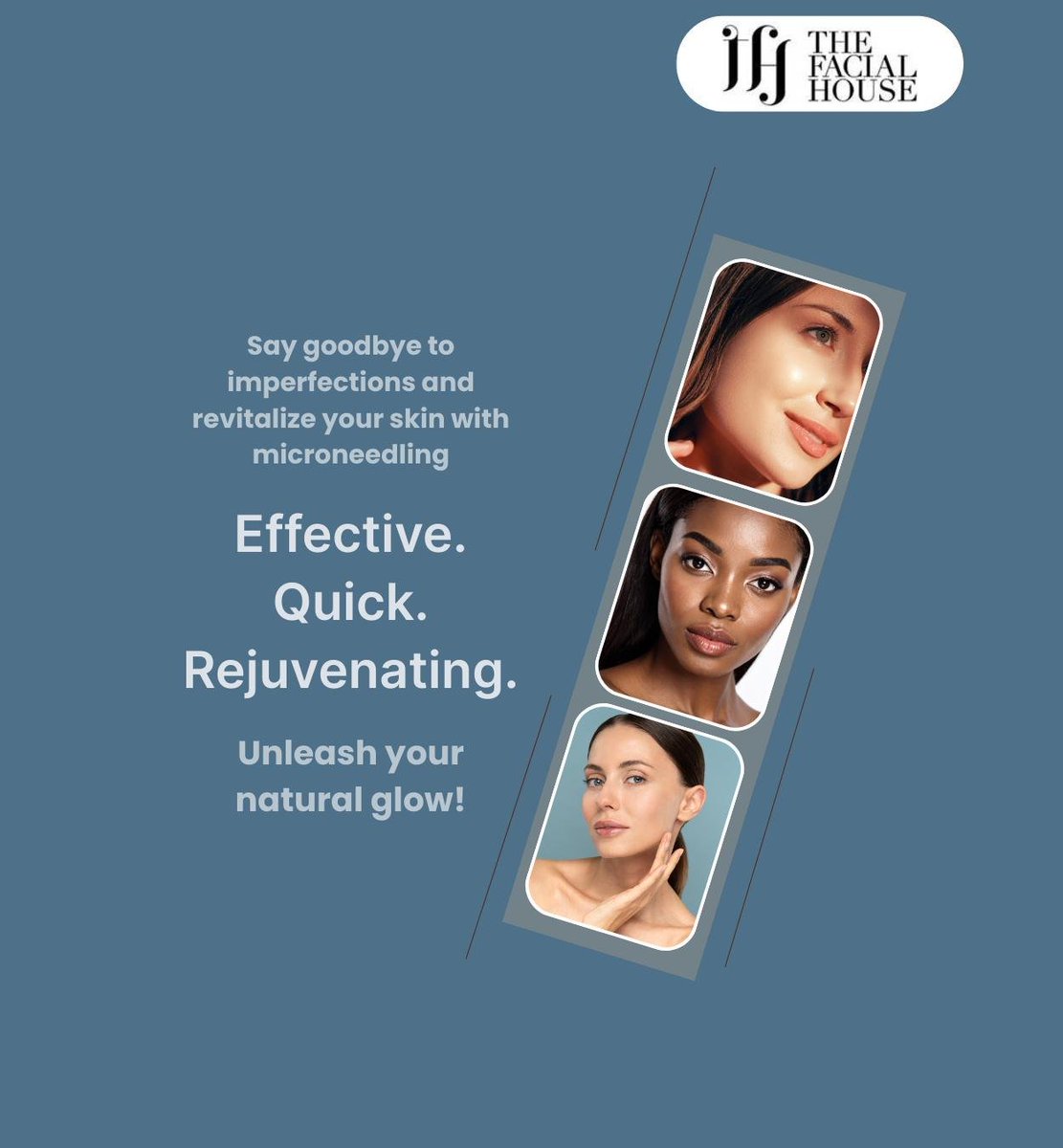 thefacialhouse's tweet image. Microneedling enhances skin tone and reduces acne scars, fine lines, and sun damage by stimulating collagen and elastin. Enjoy smoother, firmer skin with minimal recovery time. 
.
.
.
thefacialhouse.ca
289-893-2039
3 Artesian Dr, Whitby, ON L1P 1X7
.
.
.
#microneedling