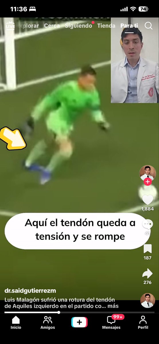 gusegrel's tweet photo. @UpalabraMX Entonces cuál fue el pie lesionado? Interesante… https://t.co/fYCbIllcJH