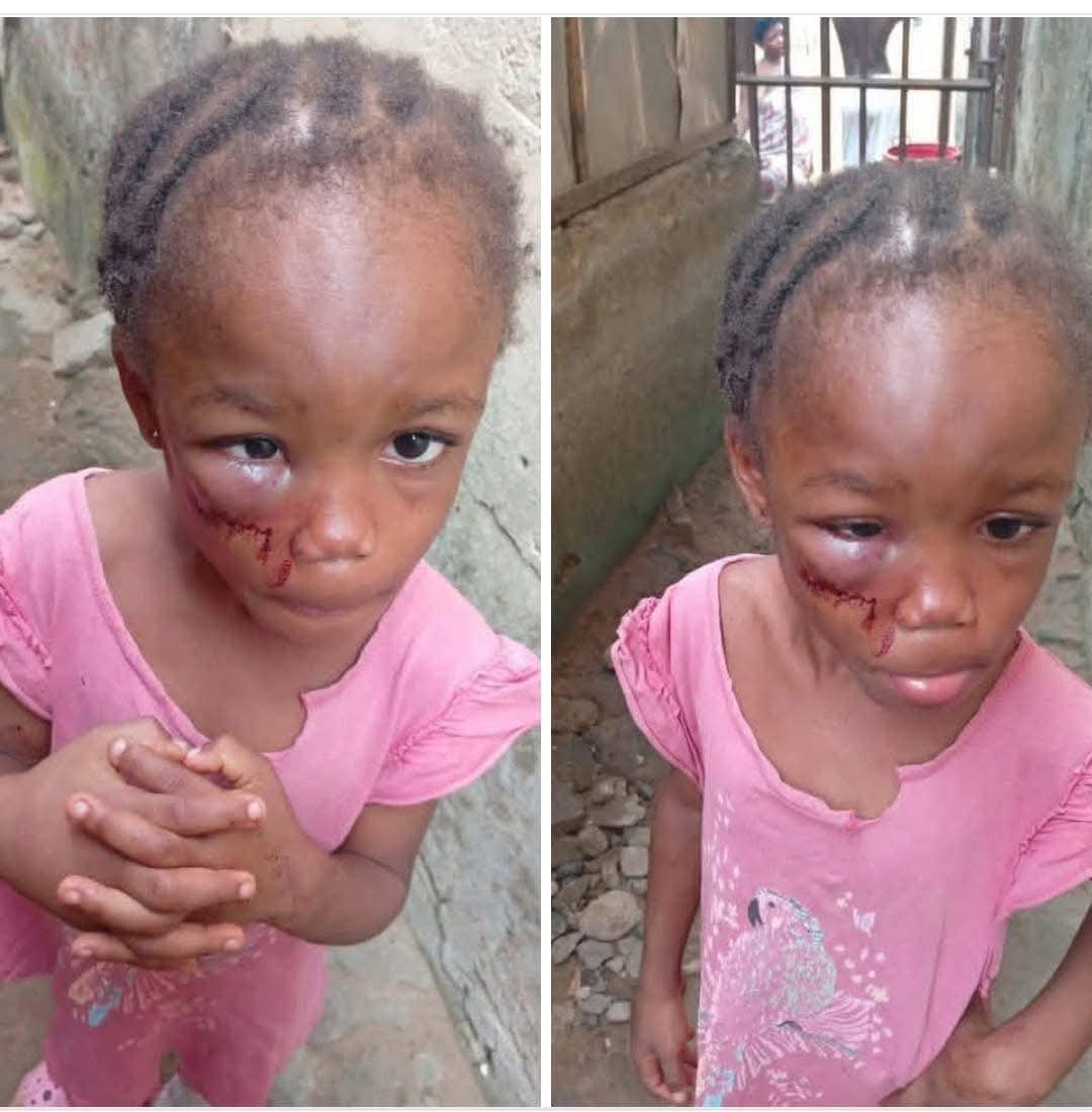 Is this not too much for a 7yr old? 💔😭💔😭💔😭💔

A 7yr old child working as a maid in a pastor's home in Calabar was beàten blue&amp;black by the pastor's wife (this girl is her niece) because she stole a meat from the pot 💔😭💔😭💔😭💔😭

This koromoto pastor's wife nearly