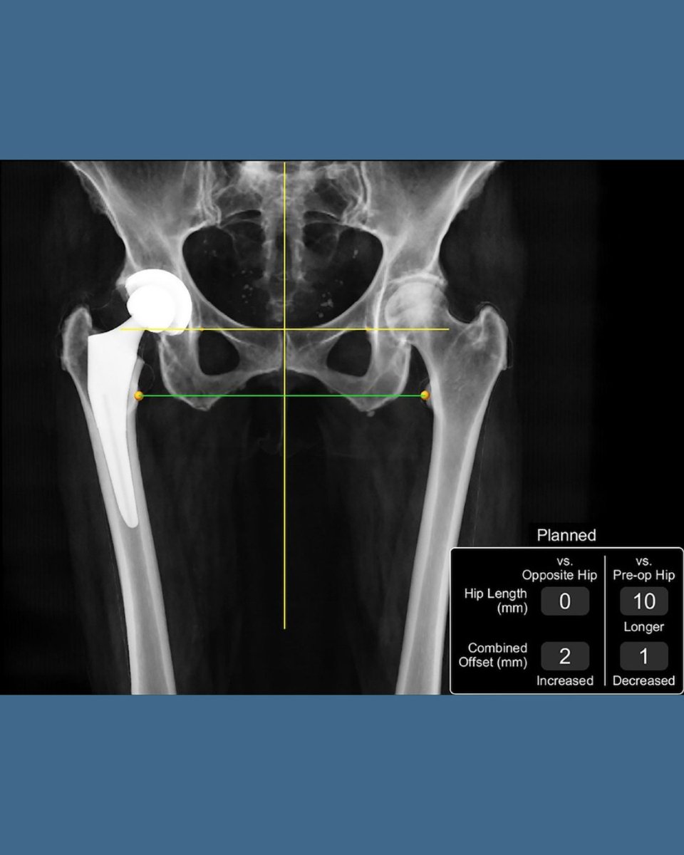 Bone & Joint Open tweet media
