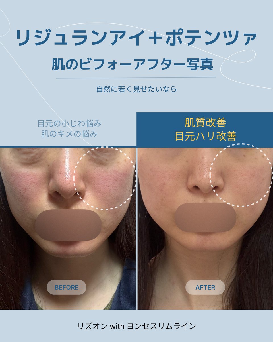 ヨンセスリムライン医院 tweet media