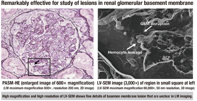 Hitachi Electron Microscope tweet media