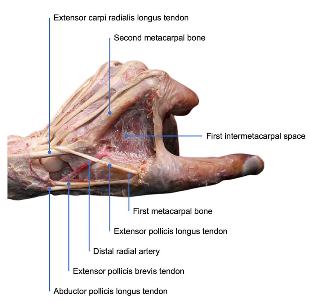 Reviews in Cardiovascular Medicine tweet media